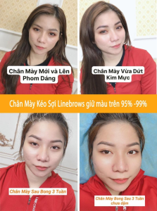 Viện Thẩm Mỹ Mộc Ý Liên