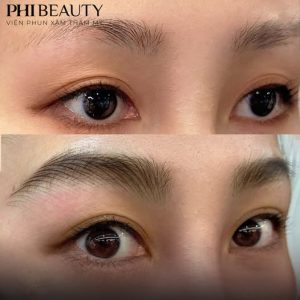 Chân mày thiếu lông bẩm sinh – Khắc phục đẹp tự nhiên tại Phi Beauty