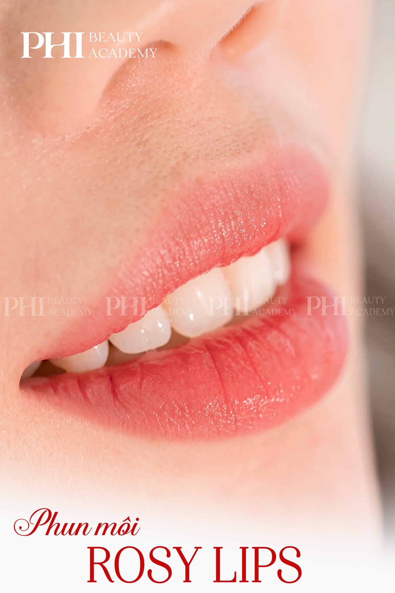 phun-moi-collagen-cho-me-bim-sau-sinh.jpg