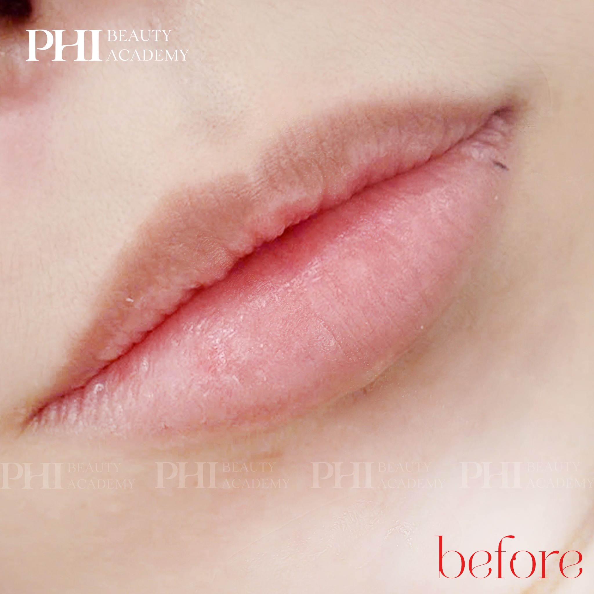 rước khi phun môi tại Phi Beauty – môi nhợt nhạt, kém tươi tắn.
